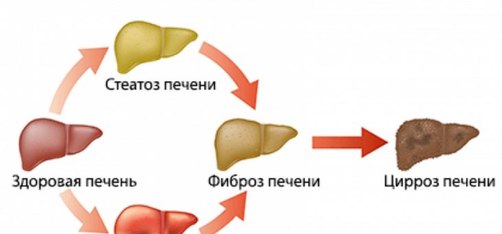 АЛКОГОЛЬ – ВРАГ ЗДОРОВЬЯ